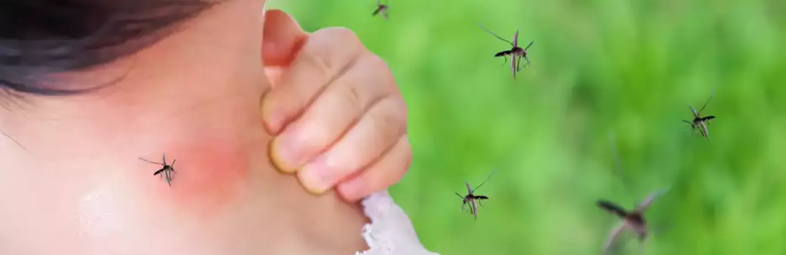 moquito-itching